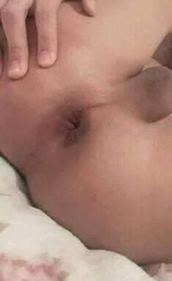 foto 3533388552
