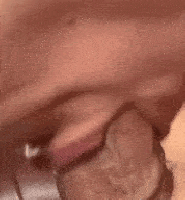 3533488204