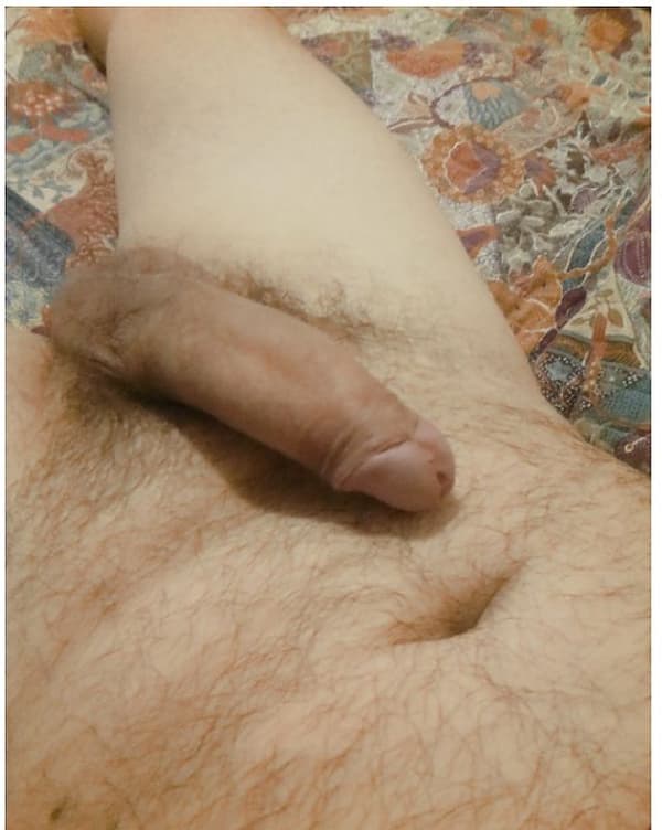 3517688869