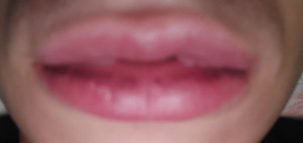foto 3519235022