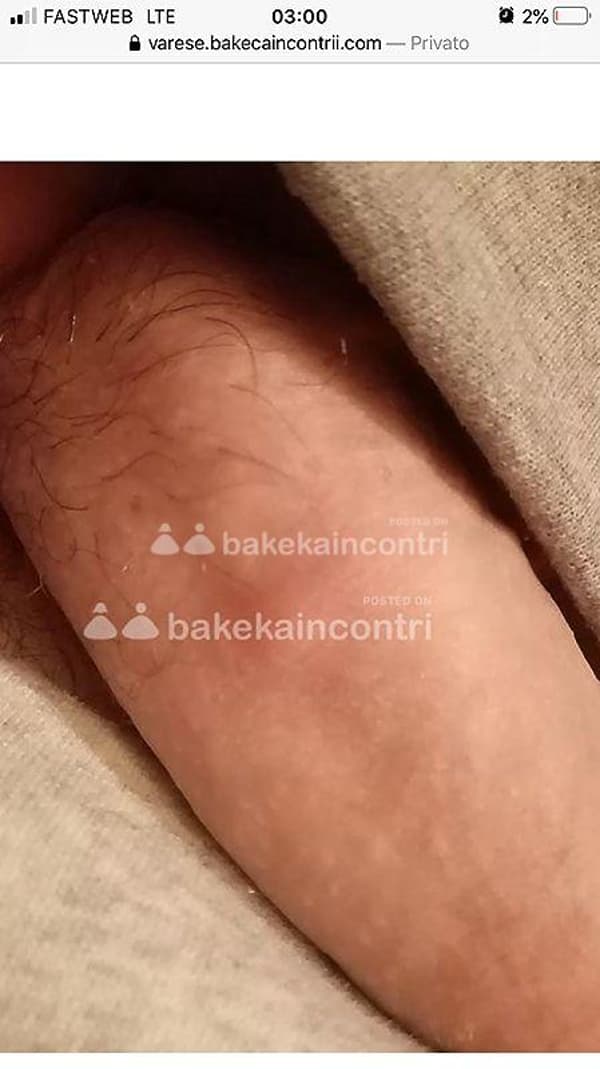 3756415479