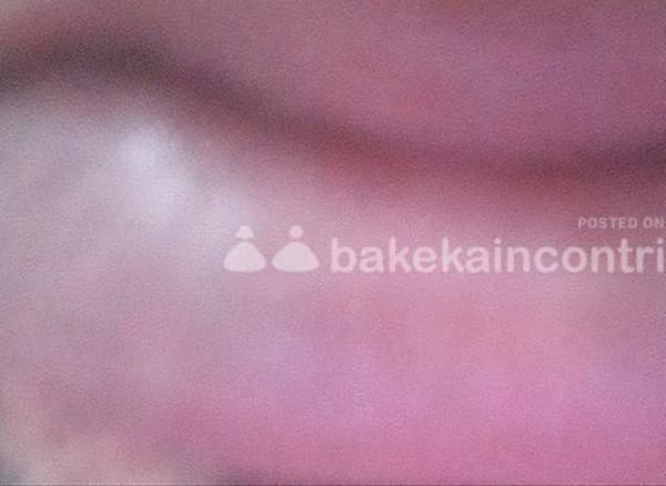 foto 3509418206