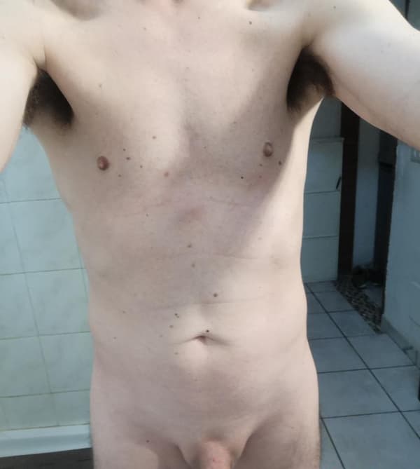 3792620532