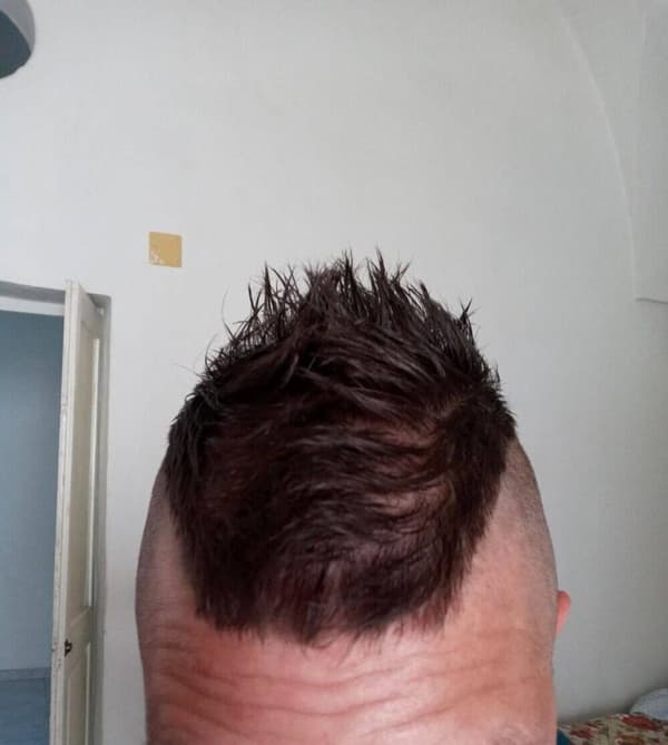 3533668724