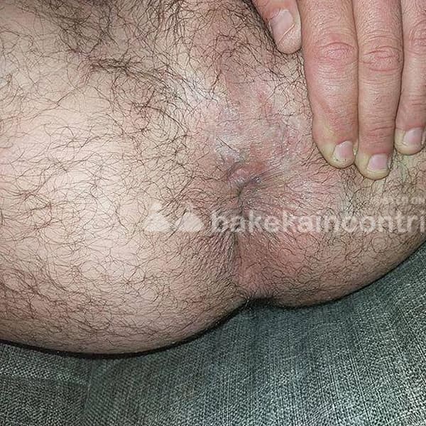 foto 3791735049