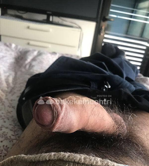 3487787581