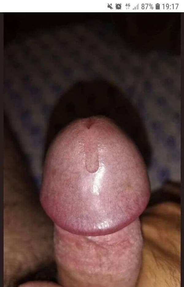 3292475721