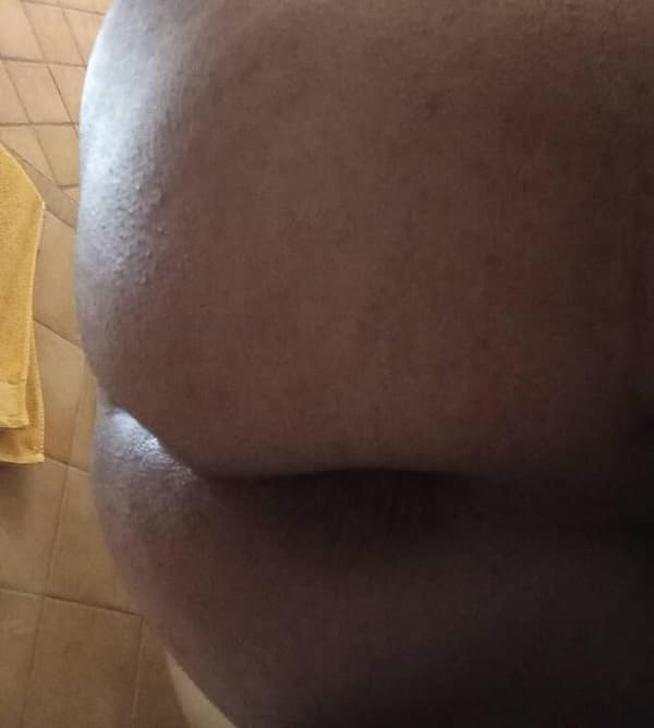 3792521884
