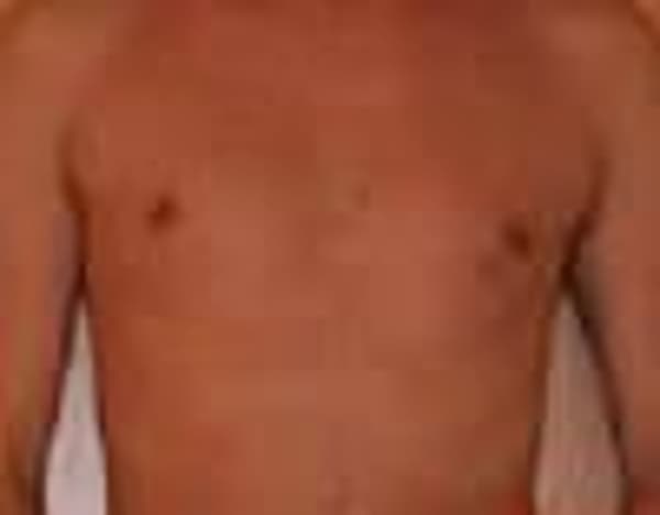 foto 3355841184