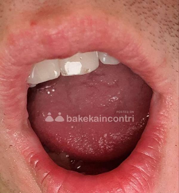 foto 3791675635