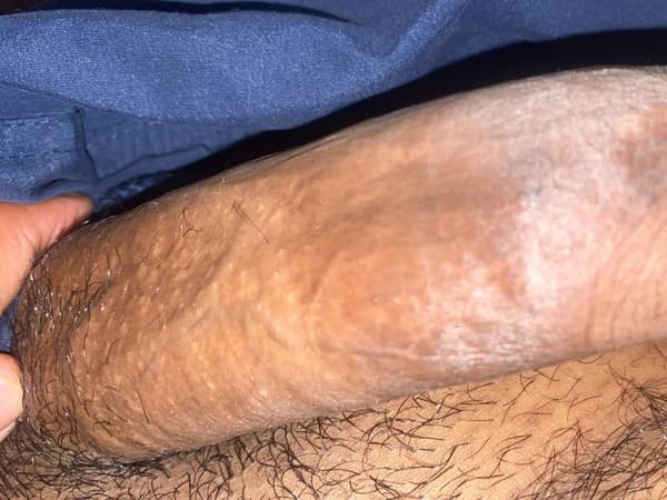 foto 3512473361