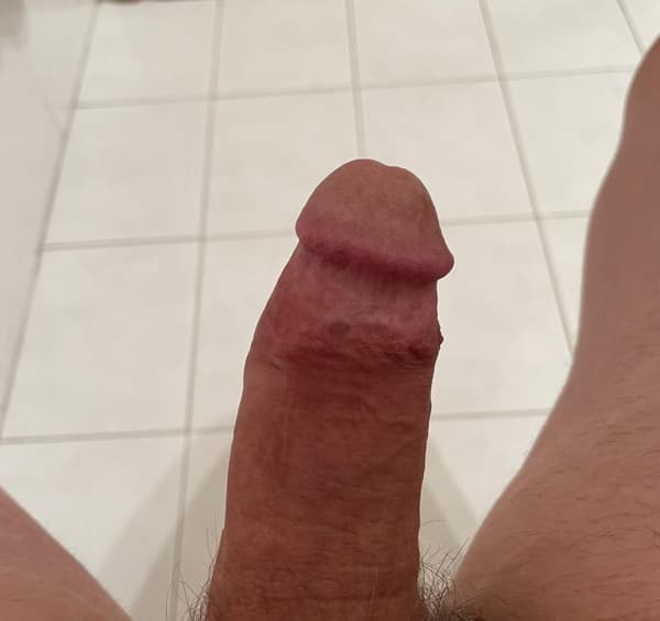 3663172677